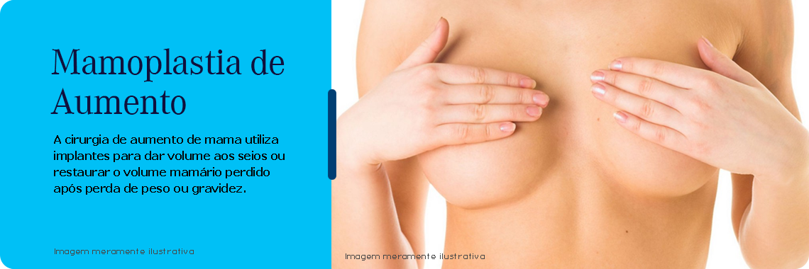 Procedimento cirugico mamoplastia de aumento
